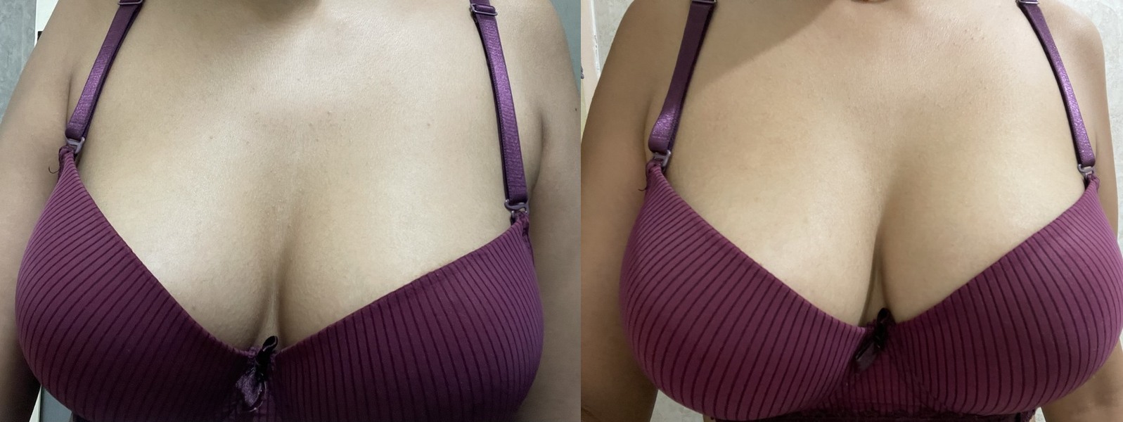 picture of a few months of botanical breast enhancement